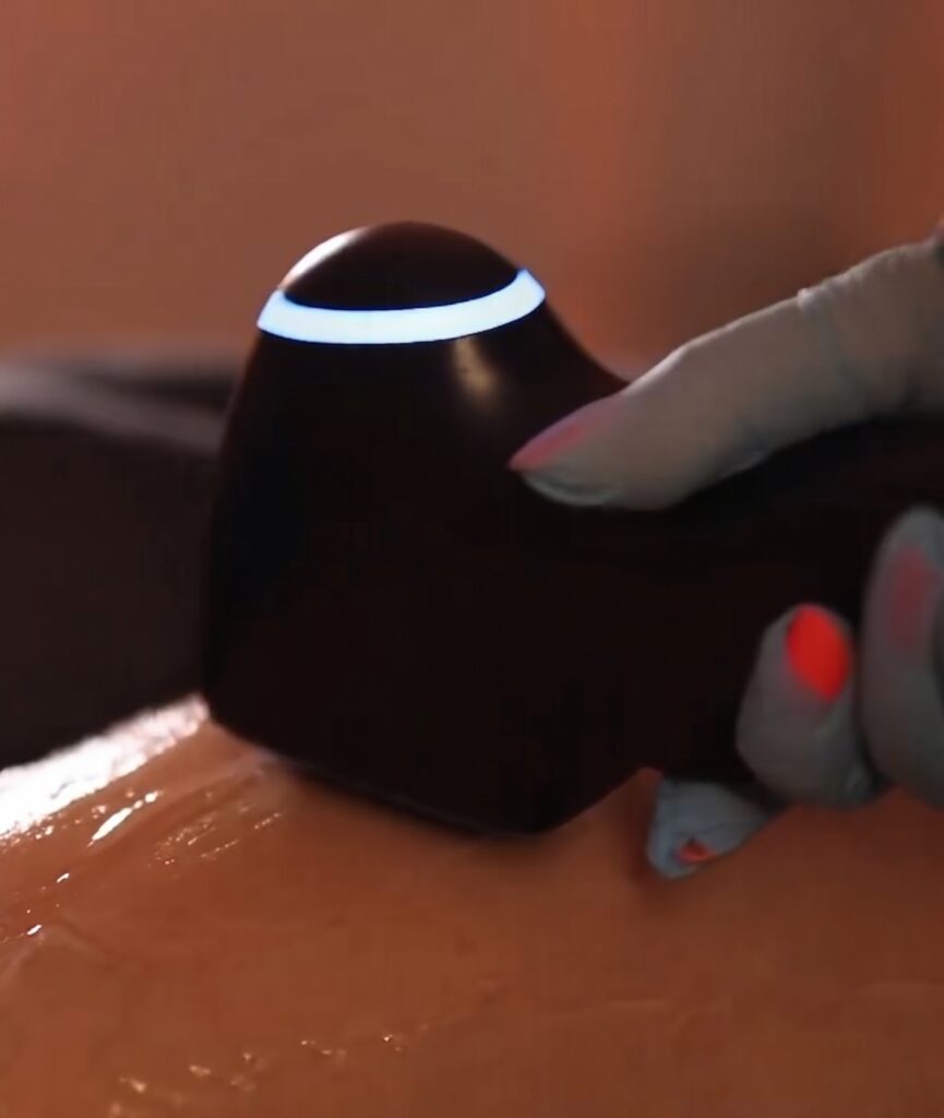 Body treatment handpiece being used on a client's skin at a beauty and body spa in Larnaca, Cyprus