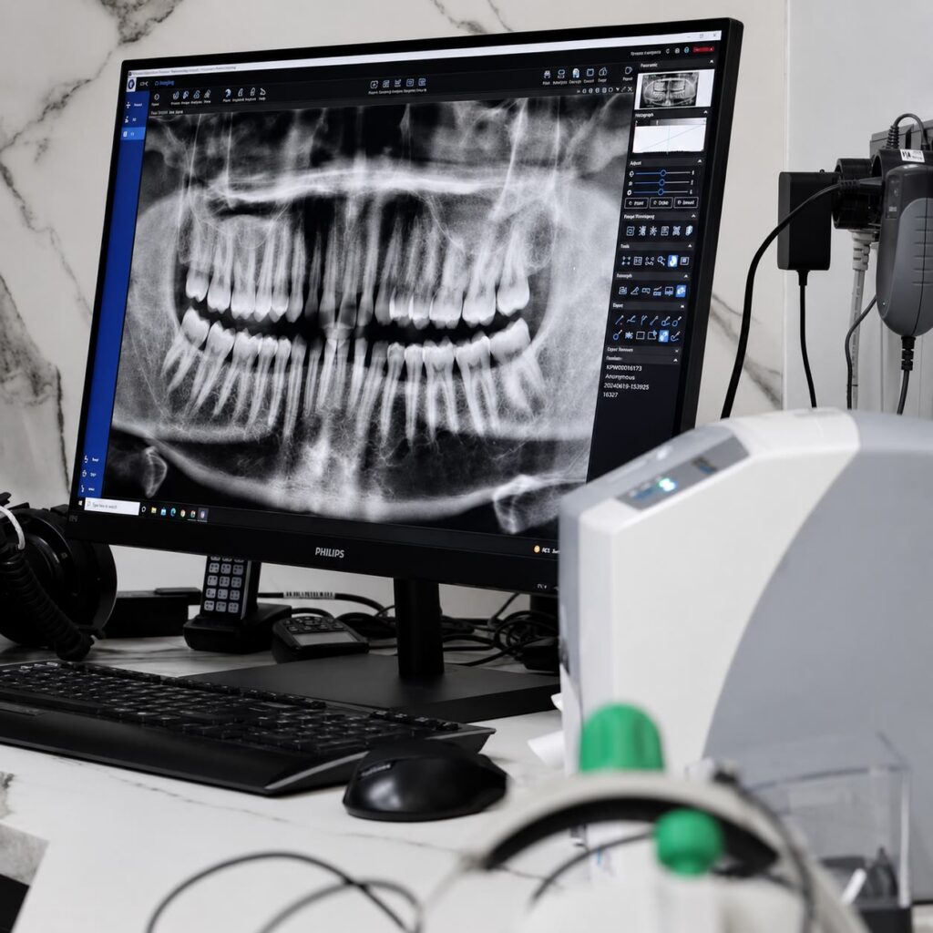 Panoramic dental X-ray of a full set of teeth displayed on a monitor in a Larnaca dental surgery